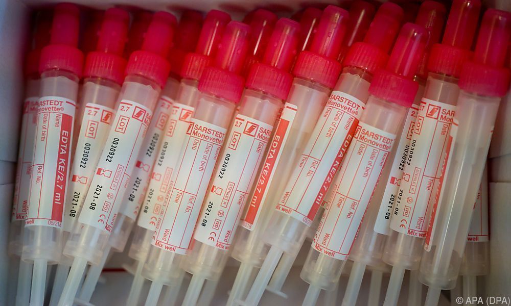 &#8220;Massentests wie Wahlen organisieren&#8221;