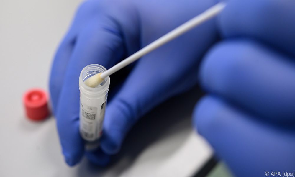 Weibliche Hormone mildern Erkrankung