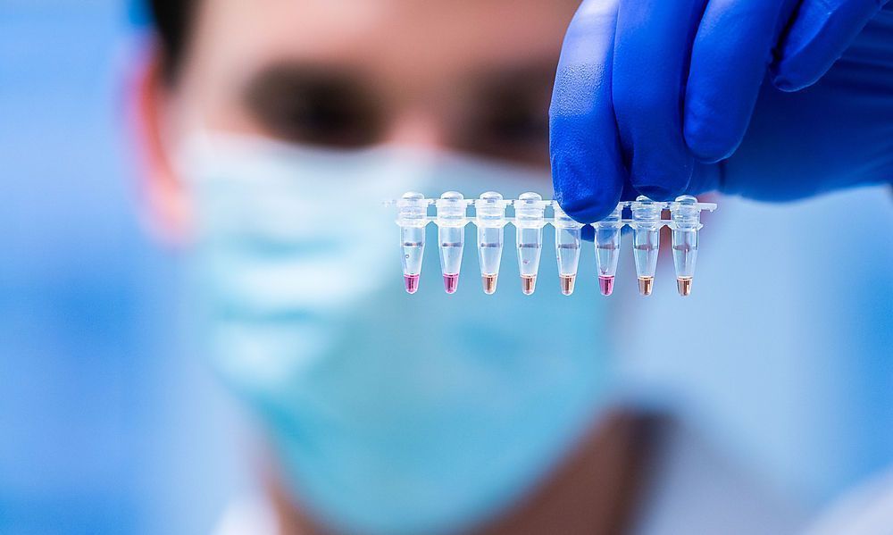 17,6 Prozent der Tests positiv