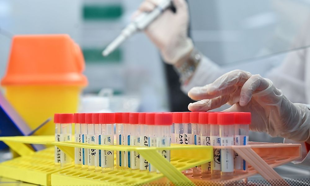 &#8220;Tests sind Schlüssel für Vereinssport&#8221;