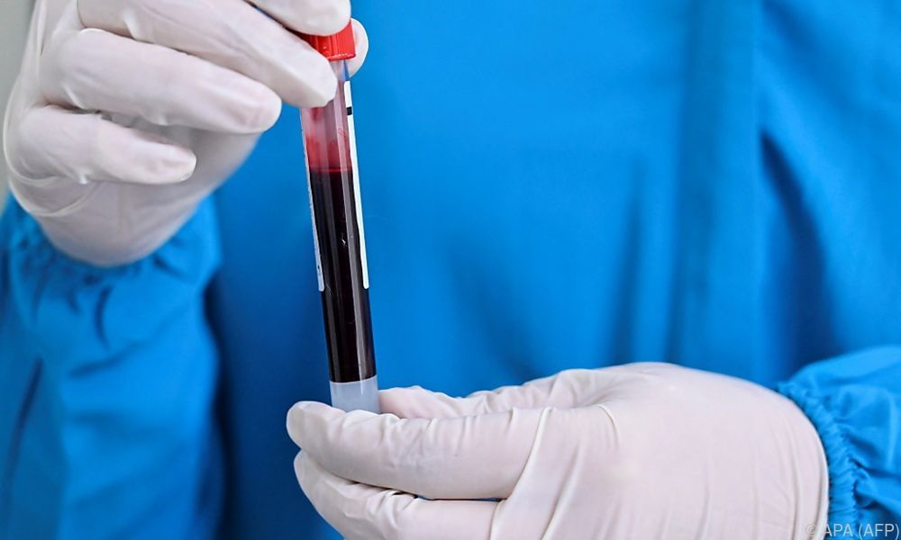 15 Tote durch &#8220;nicht identifizierte&#8221; Krankheit