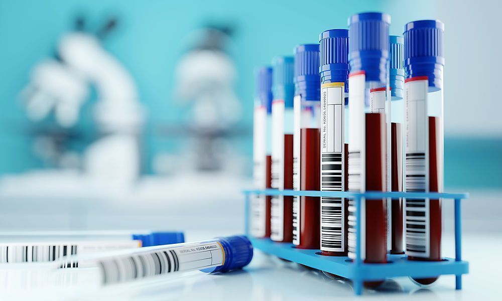 Blutproben zeigen Achillesferse des Virus