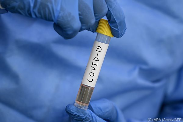In Kürze bis zu 30.000 tägliche Corona-Fälle erwartet