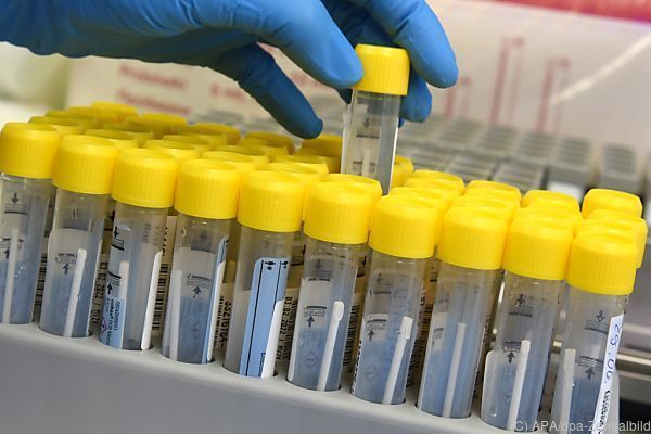 3.335 Corona-Neuinfektionen in Österreich