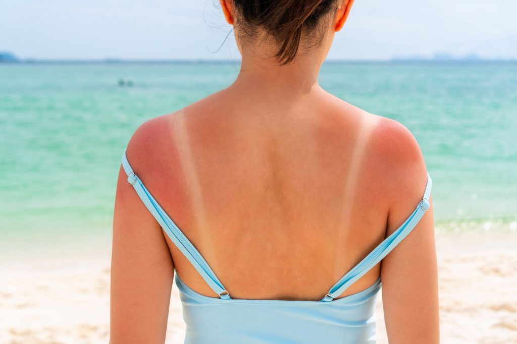 Warum Sonnencreme nicht ausreicht