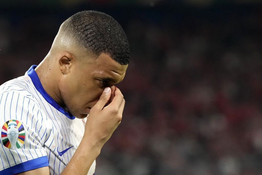 „Nase der Nation“ –  Kylian Mbappe muss unters Messer