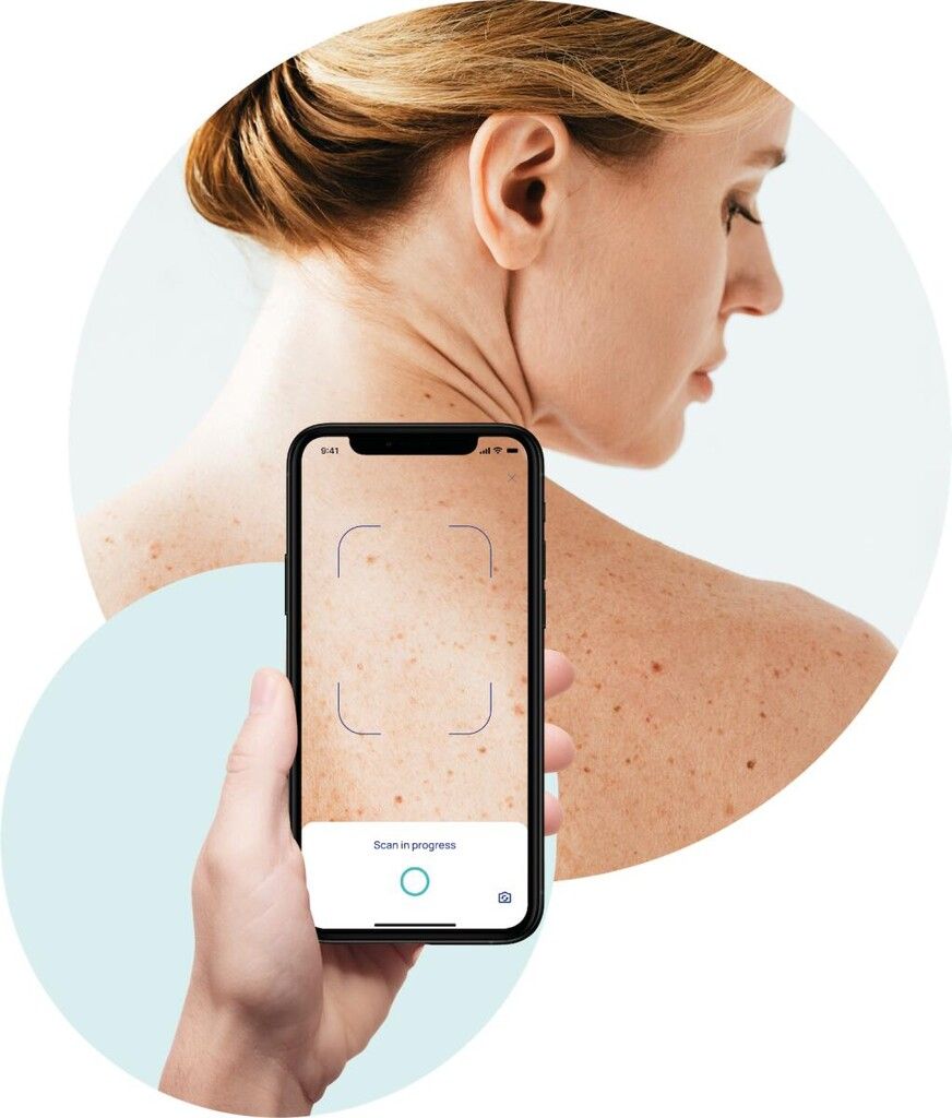 Portugals Gesundheitsministerium setzt auf steirische Hautkrebs-App