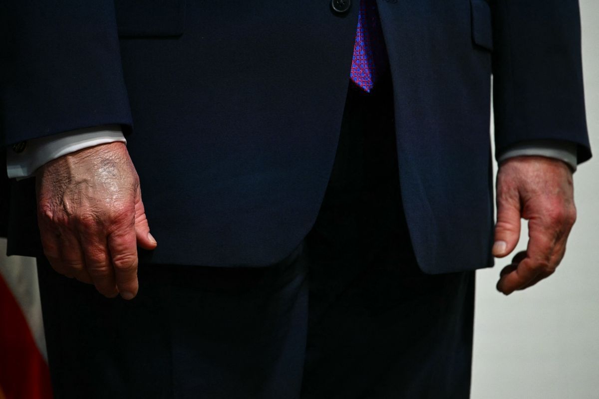 Arzt bescheinigt US-Präsident Trump beste Gesundheit