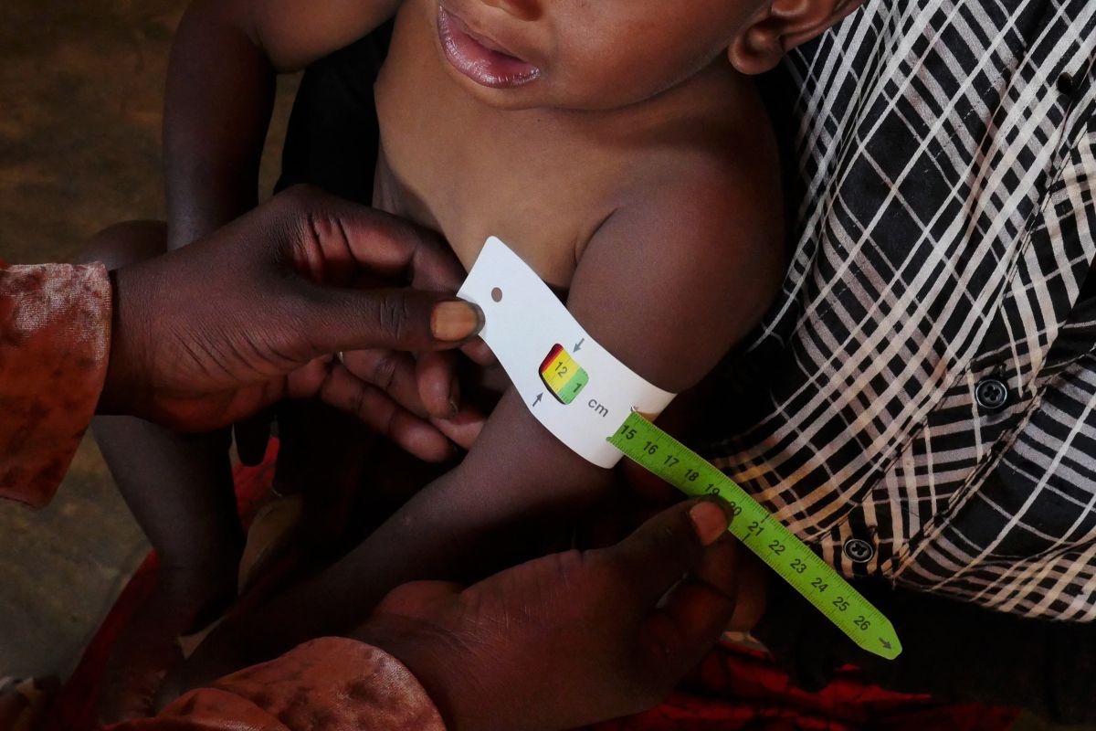 150 Millionen Kinder weltweit chronisch mangelernährt