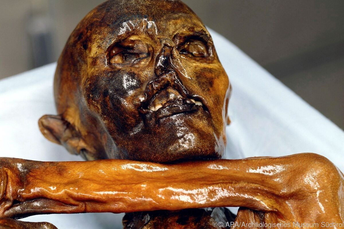 Mumienforscher sieht "Ötzi"-Krankheiten und Umwelt im Fokus